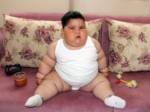 1,5 Yaşında 32 Kilo