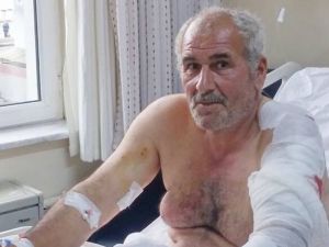 Ayı Saldırısına Uğrayan Vatandaş Yaralı Kurtuldu