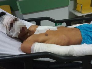 Çakmak Gazı Dehşeti: 4 Çocuk Yaralı