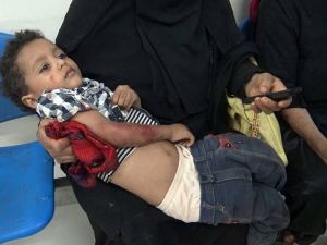 Yemen’de Çatışma: 6 Ölü, 20 Yaralı