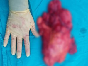 Bu Bacağından Çıktı