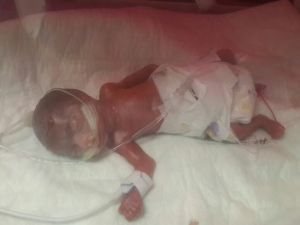 560 Gram Doğan Erva Bebek 4 Ay Sonra Taburcu Oldu