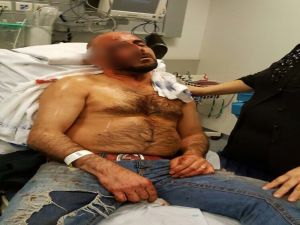 Belçika’da Türk Vatandaşa Erdoğan Dayağı