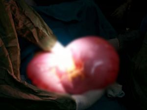 Karnından Çıkan Doktorları Bile Şok Etti