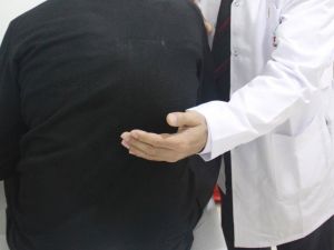 Yaz Aylarında Böbrek Taşına Dikkat !