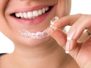 Invisalign Tedavisiyle İlgili Bilinmesi Gereken 12 Nokta