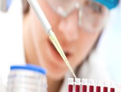 10 milyon kişinin kolesterolü yüksek