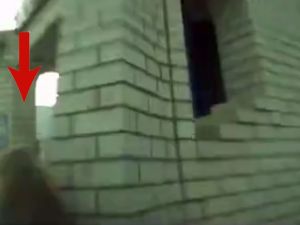 Sarhoş Kadın Sürücü Masum Çocuğu Bacağından Etti