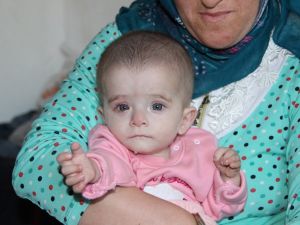 Kanser Hastası 10 Aylık Alime’nin Bakışları Yürek Yakıyor