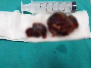 Bu Bir İnsanın Kalbinden Çıktı