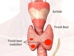 Hızlı Kilo Değişimi Tiroidden Olabilir