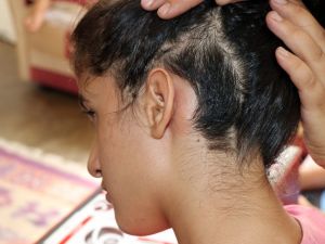 15 Bin Liralık Biyonik Kulaklık Alınmazsa Derya Duyamayacak