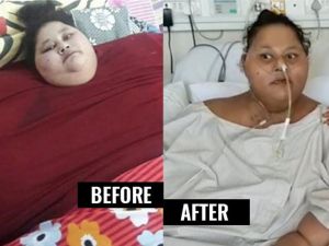 Dünyanın En Şişman Kadını Hayatını Kaybetti