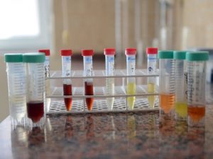 Elektronik Sigarada Gizli Tehlike: Aroma