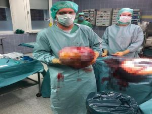 İkiz Bebek Sandılar: Karnından Bu Çıktı