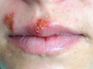 Uçuk Deyip Geçmeyin