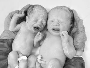 İzmir’de Tıp Tarihine Geçecek Olay 