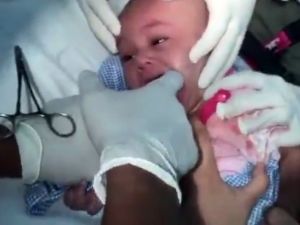 Boğazına Saat Kordonu Kaçan Çocuk Böyle Kurtarıldı