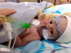 8 Haftalık Bebeğe Kalp Nakli