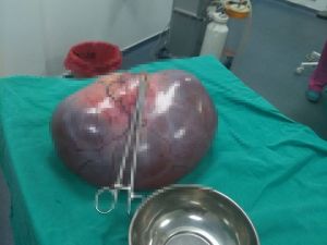 Bu Bir Kadının Karnından Çıktı