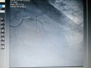 Türkiye’de İlk Kez Yaşandı !