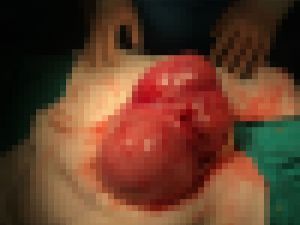 Rahminden 4 Kiloluk Kitle Çıktı