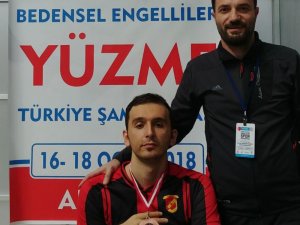 Yüzme Sevdası Yüzünden Sakat Kaldı Ama Pes Etmedi