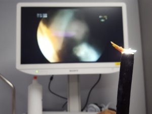 Tavuk Yerken Az Daha Ölüyordu!