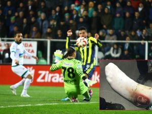 Fenerbahçe Hasan Ali Kaldırım’ın Ayağının Fotoğrafını Paylaştı