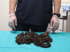 Bu Bir Kız Çocuğunun Midesinden Çıktı