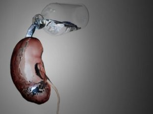 “Bira İçerek Böbrek Taşı Düşürülür Kanısı Yanlış"