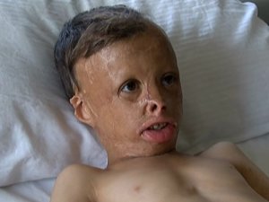 İstanbul’da Ameliyat Edildi