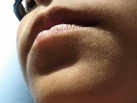 Ke ke kekemeleri konuşturan program: