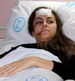 Elif, O Anı Anlattı