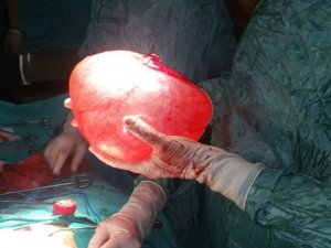 Bu Bir İnsanın Karnından Çıktı !