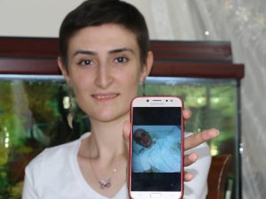 Bir Yılda Kanseri Yendi, Şimdi Diğer Hastalara Umut Dağıtıyor