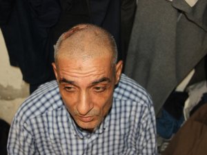 20 Yıldır Kafasında Çivilerle Yaşıyor