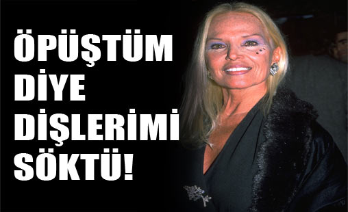 Öpüştüm diye dişlerimi söktü