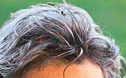 Beyaz saçlar kanseri engelliyor