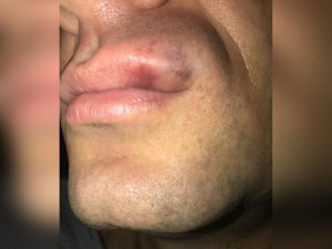 Hakeme Kafa Atan Futbolcuya 20 Maç Ceza