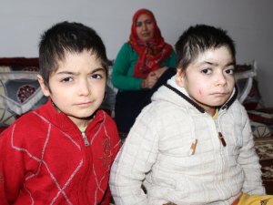 Kelebek Hastası Kardeşlerin Dramı Yürek Burkuyor