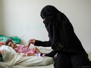 "Yemen’de 7,4 Milyon Çocuk Yetersiz Besleniyor"