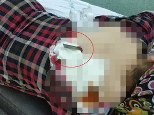Sırtına Saplanan Bıçakla Hastaneye Kaldırıldı