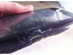 13 Yaşındaki Kızın İphone’u Cebinde Alev Aldı