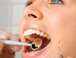 Beyaz dişler için bunlara dikkat!