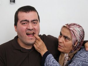 Zihinsel Engeli Tayfun Üç Aydır Diş Ağrısı Çekiyor