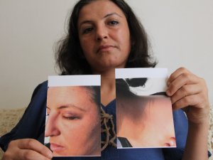 "Emine Bulut Gibi Çocuklarımın Önünde Ölmek İstemiyorum”