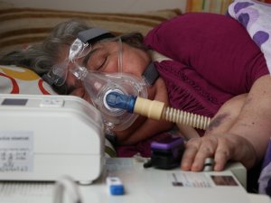 57 Yaşındaki Zümrüt Teyze, Rahat Nefes Alabilmek İstiyor