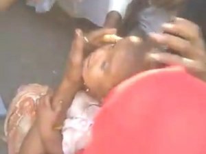 Kafası Tencereye Sıkışan Küçük Kızı Kurtarma Operasyonu