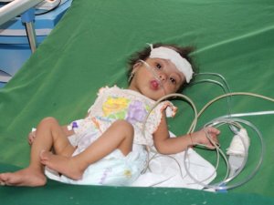 “400 Binden Fazla Yemenli Çocuk, İleri Derecede Yetersiz Beslenme Sorunu Yaşıyor”